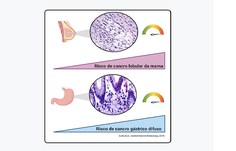Study clarifies risk mutations for the development of Hereditary ...
